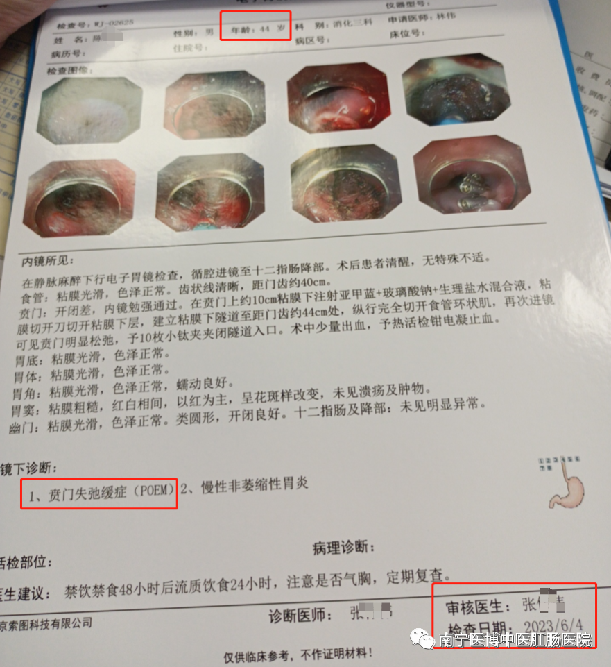 【新技术】南宁医博医院成功开展首例贲门失弛缓症poem手术